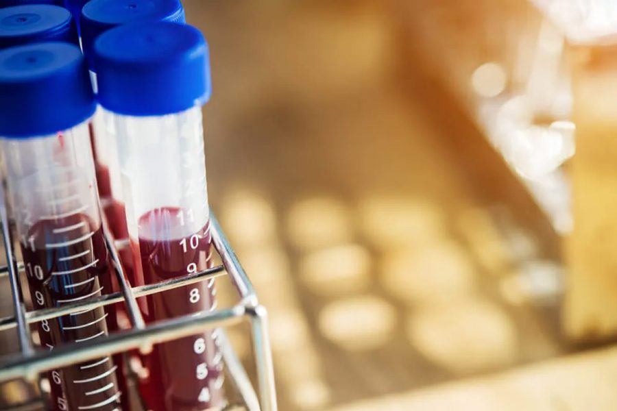 Área Hematología